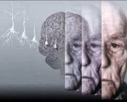Ενημερωτική Ομιλία για την νόσο Alzheimer στην Έδεσσα