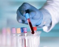 Νέο τεστ αίματος θα βοηθά στην ταχύτατη διάγνωση του καρκίνου