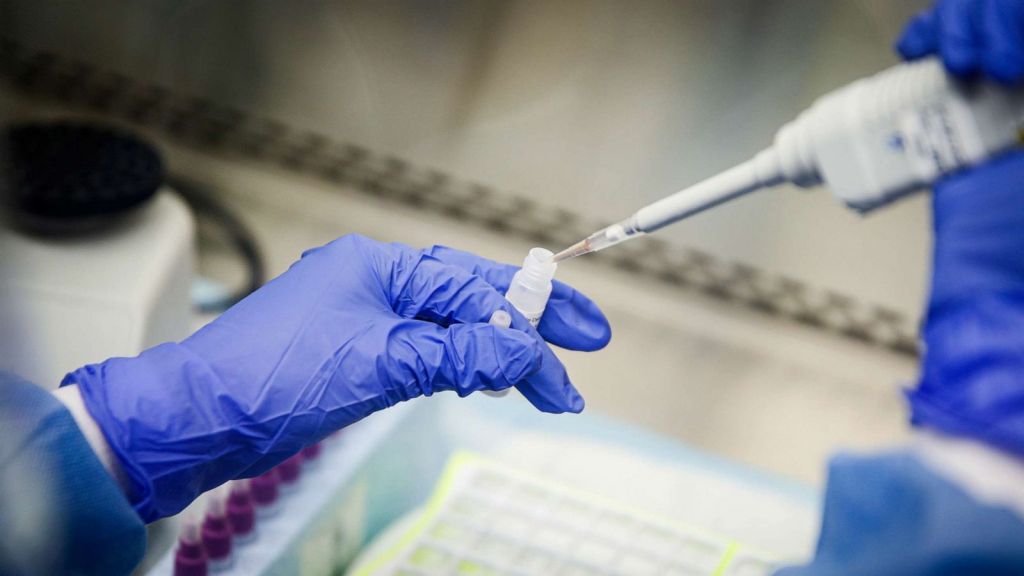 Επίσημο: Στα 47 ευρώ η ανώτερη τιμή των PCR test